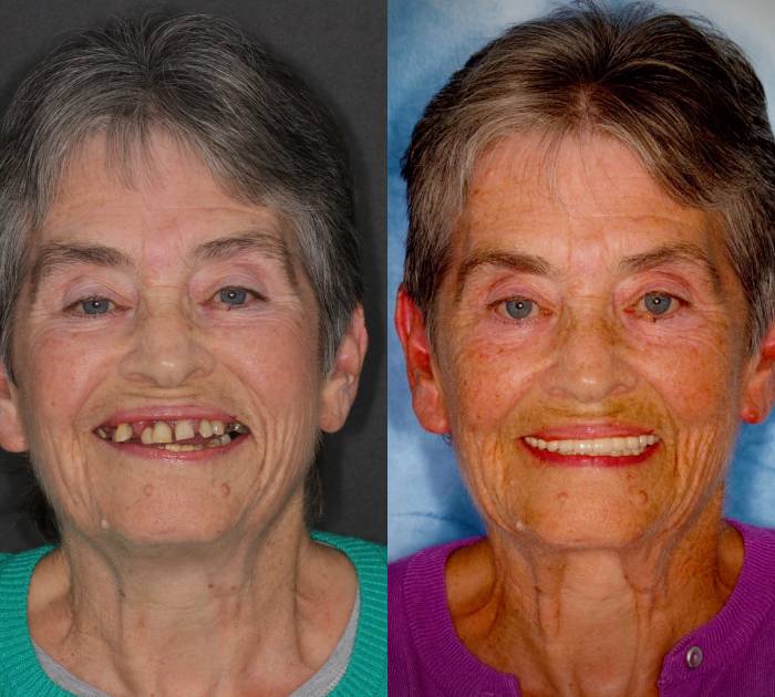 before-after-img-1.jpg