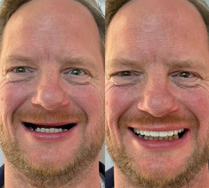 before-after-at-dental-implant-centre.jpg