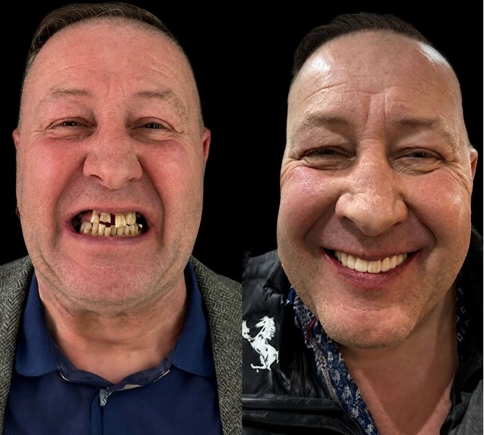 dental-implant-reading.jpeg (1)