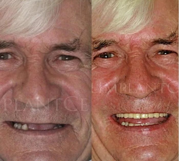 dental-implant-reading.jpeg (2)