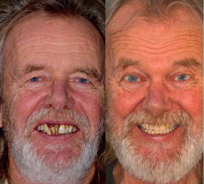 dental-implant-reading.jpeg (3)