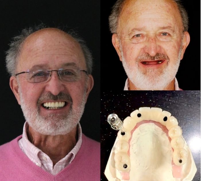 dental-implant-reading.jpeg (4)